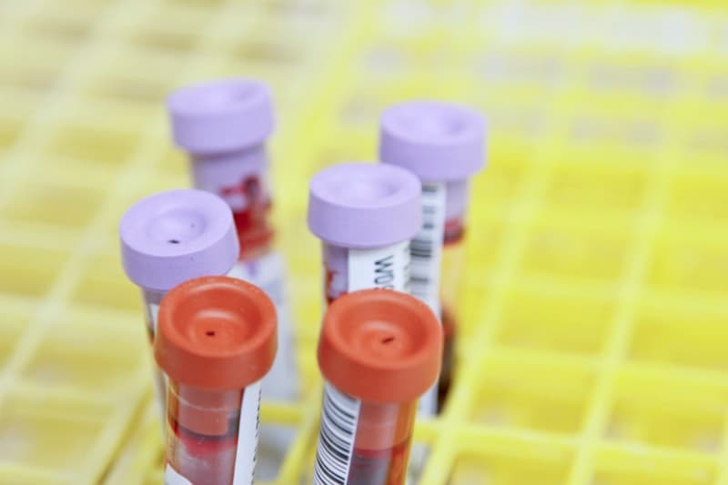 Blood collection tubes in a laboratory
